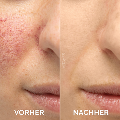 Perfector Vitamin C 10% Serum – Mit Hyaluron 30 ml