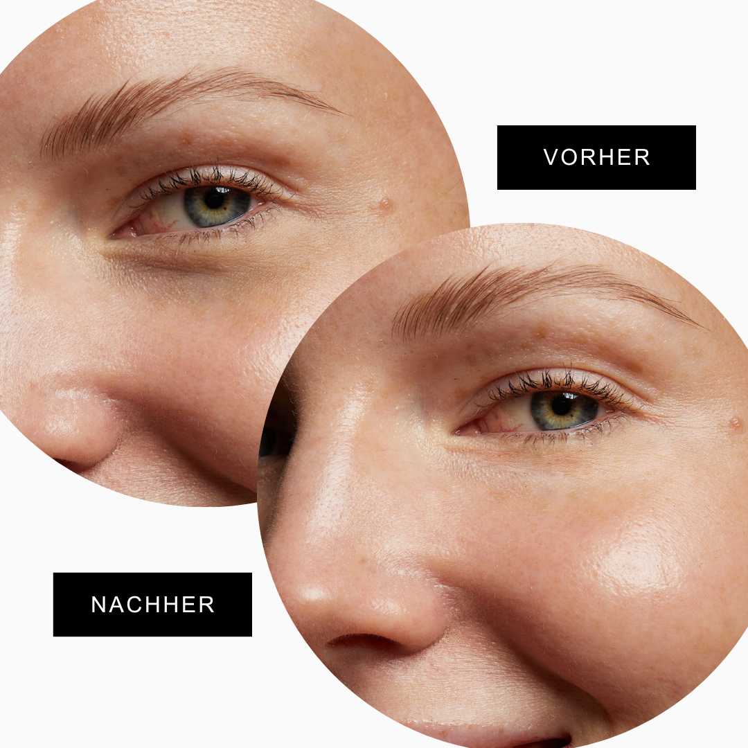 "Goddess" Eye Pads + Eye Serum