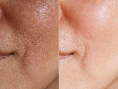 Perfector Vitamin C 10% Serum – Mit Hyaluron 30 ml